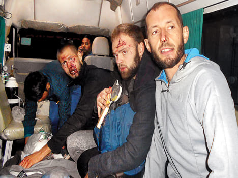 Accident on Agra Express, injured four foreign tourists