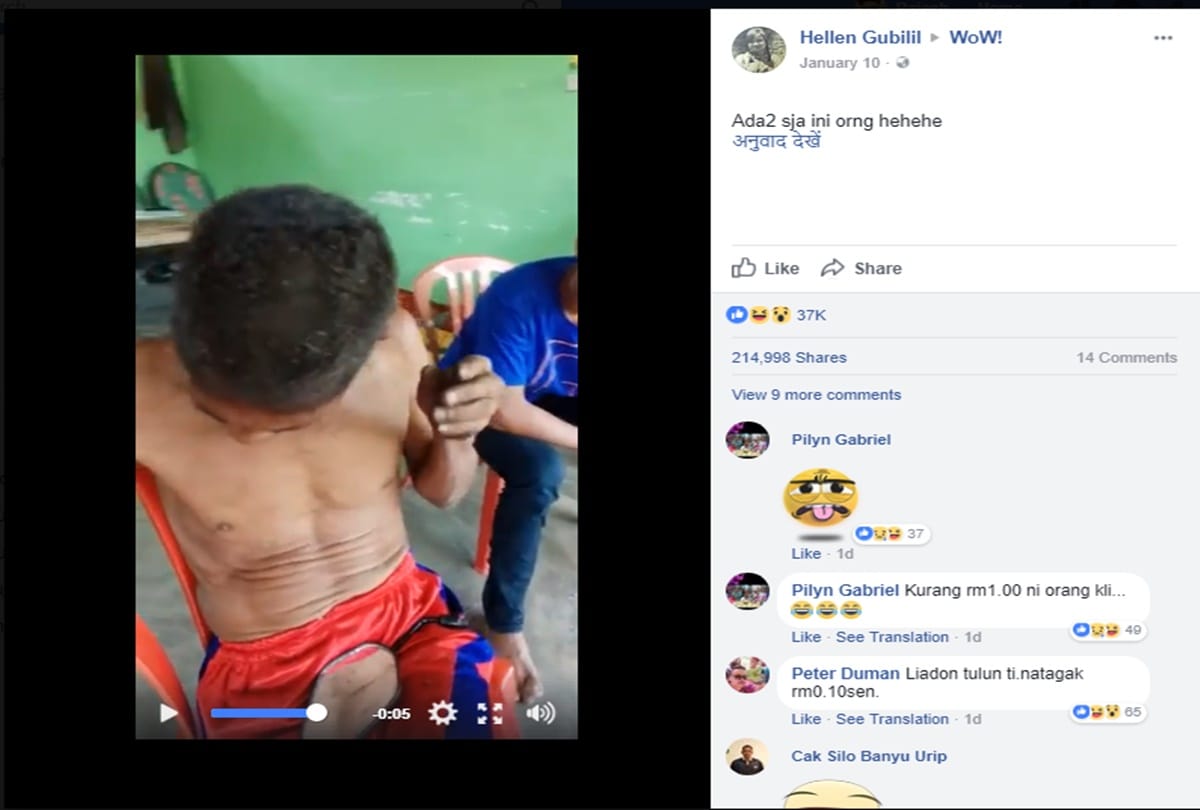 Shocking video viral of a man who burn his hair 