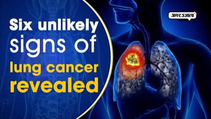 Six unlikely signs of lung cancer revealed
