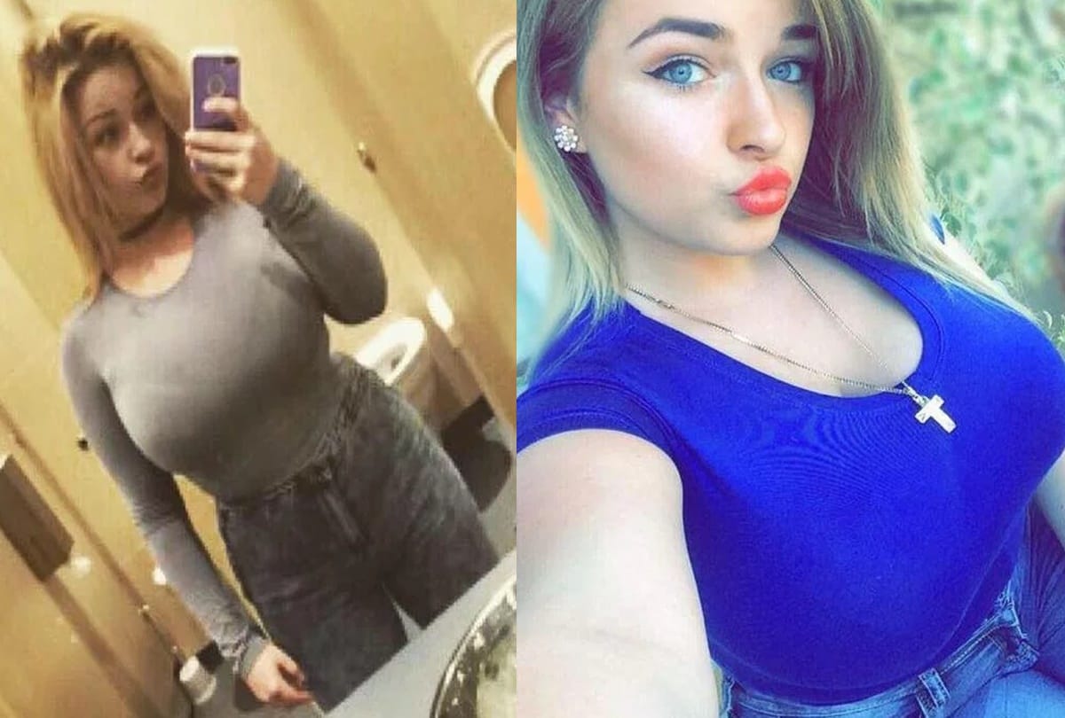For reducing breast size women demand crowdfund online 
