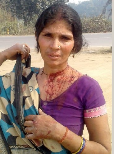 कंडे उठाने को मना किया भाभी को जख्मी कर दिया