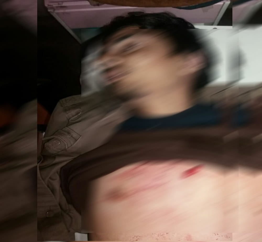 Brutal murder for car damage during accident in dehradun