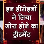 Bollywood actresses who went for skin lightening treatment for fairness special story
