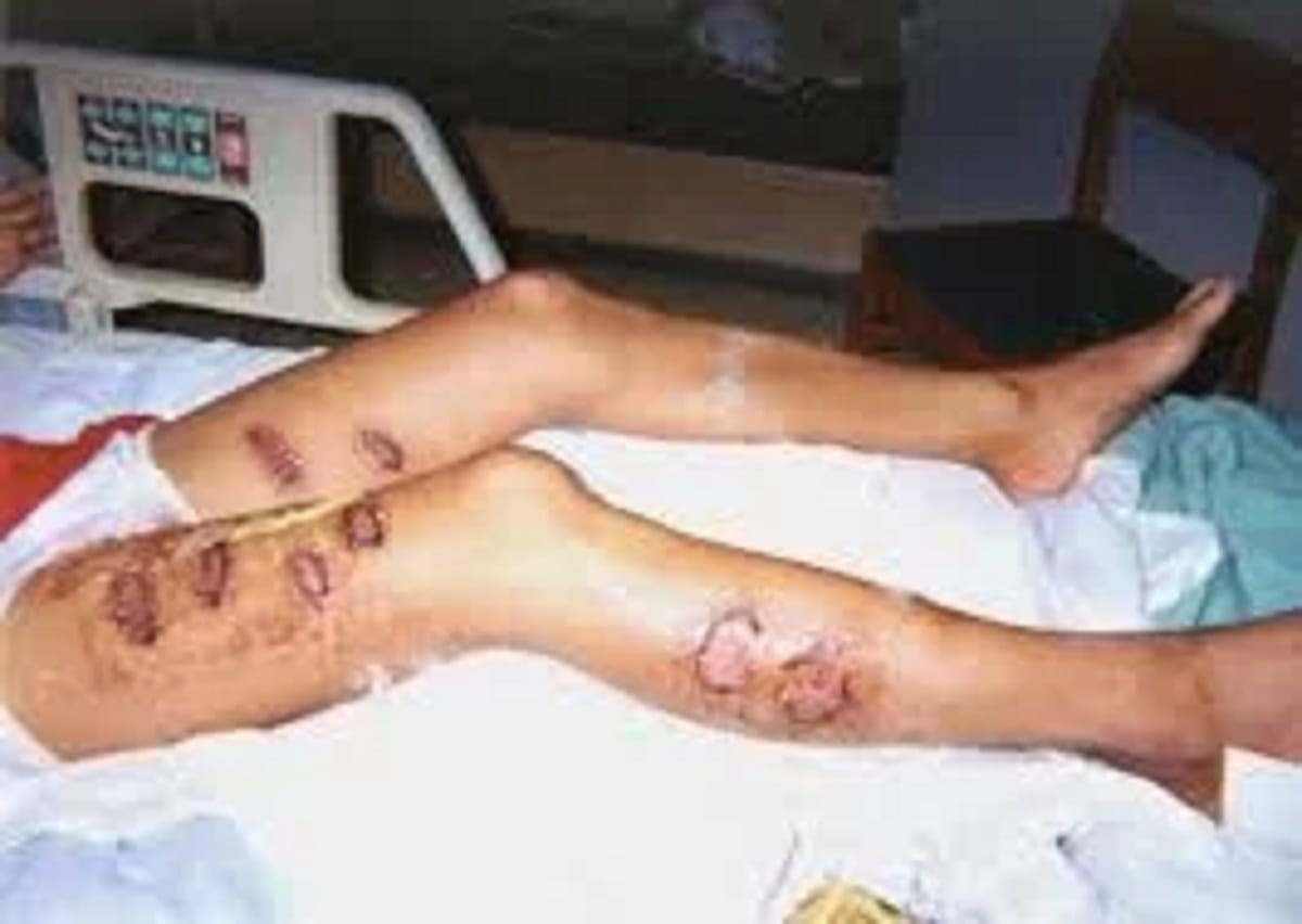 UP police used third degree on young man in Moradabad