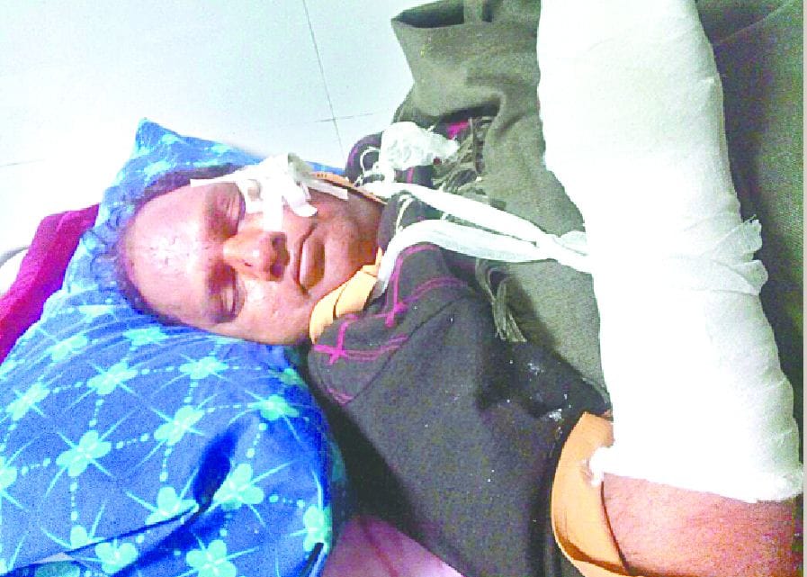 कवि बलराम श्रीवास्तव मार्ग दुर्घटना में घायल
