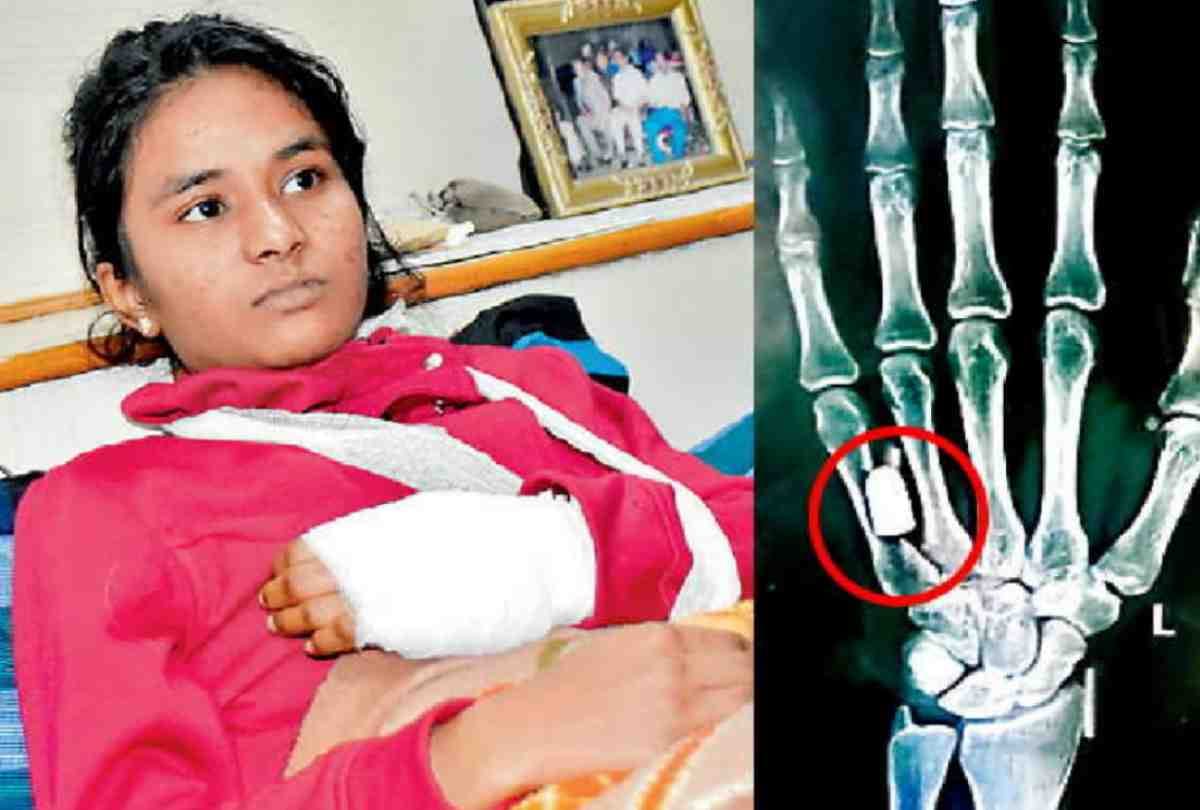 gun bullet found in ludhiana girl finger