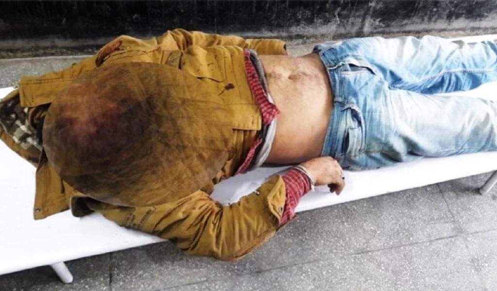 एनकाउंटर