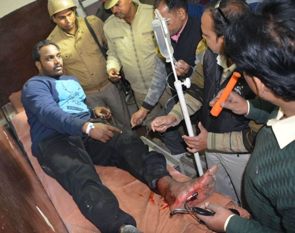 police and between sharp shooter encounter in firozabad 