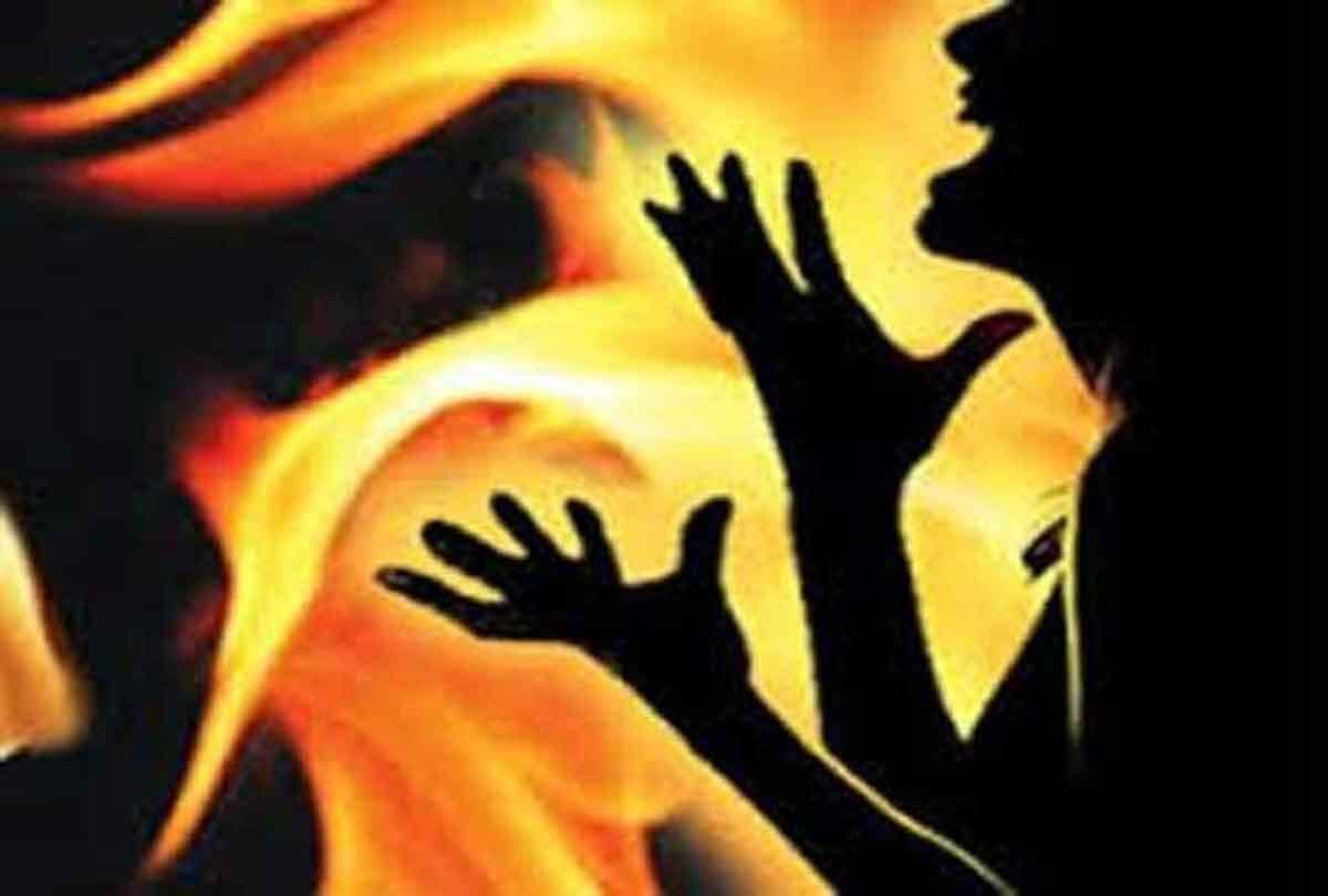 23 year old girl burned herself in up