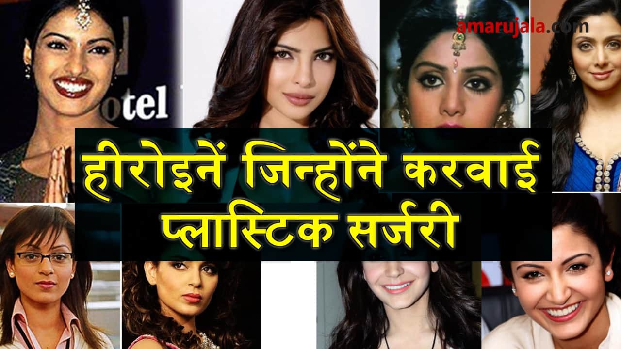 bollywood actresses who went for plastic surgery to look more beautiful special story 