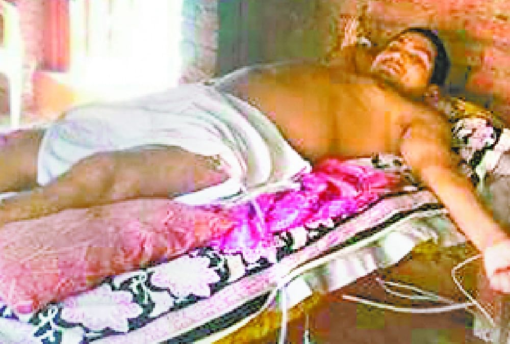 yogi promises help for an accident victim of gonda on twitter.