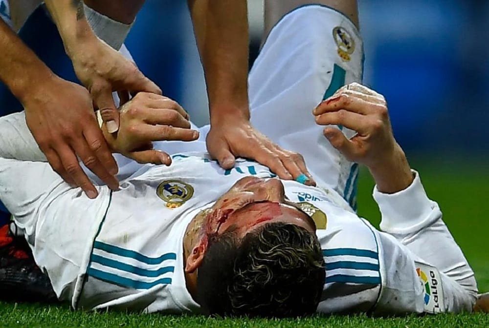 Cristiano Ronaldo injured on ground in la liga league