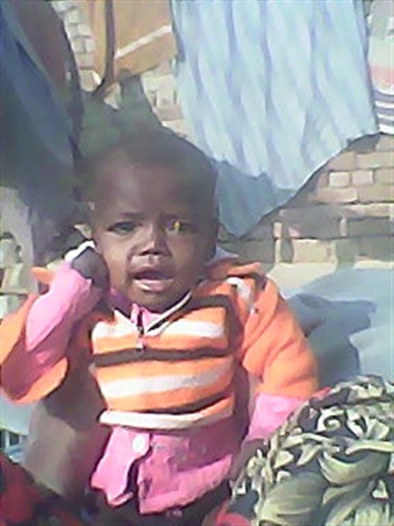 Malnutrition swallowed Dolly's corruption