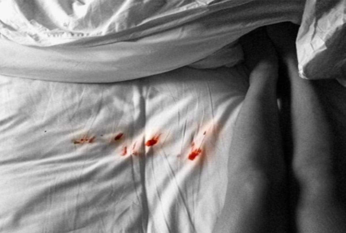 Group of young boys thrashed in Pune for opposing Virginity Test of Bride