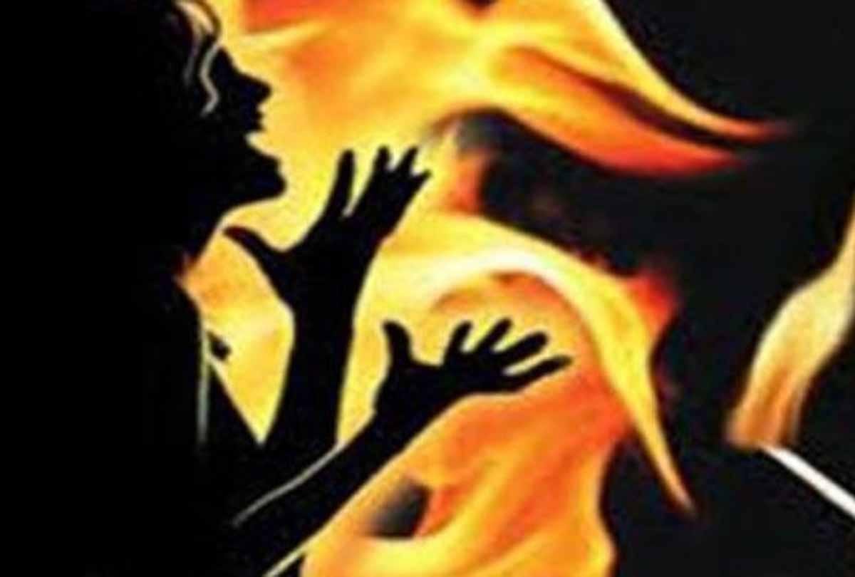 women in auriaya burned her self