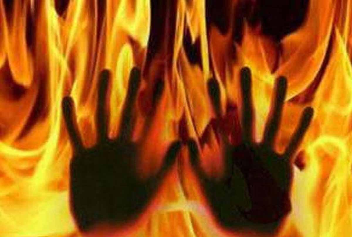 women in auriaya burned her self