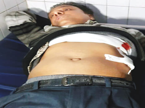 Crooks shot Incharge CMS