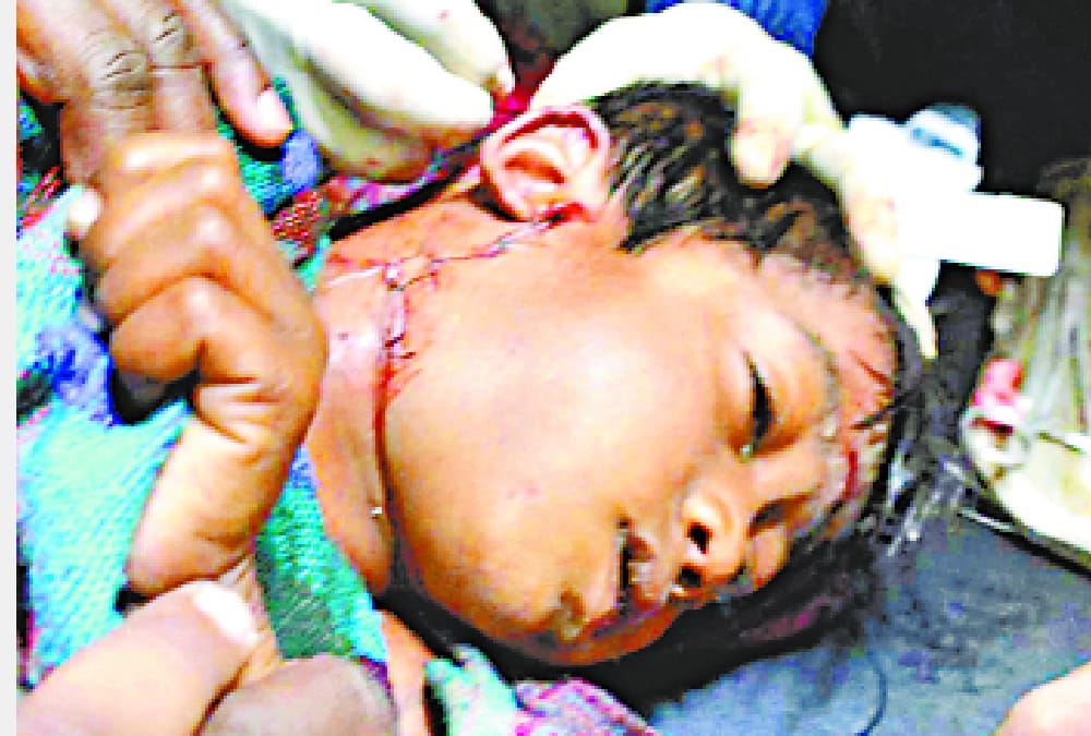 dogs attacked on children in sitapur.