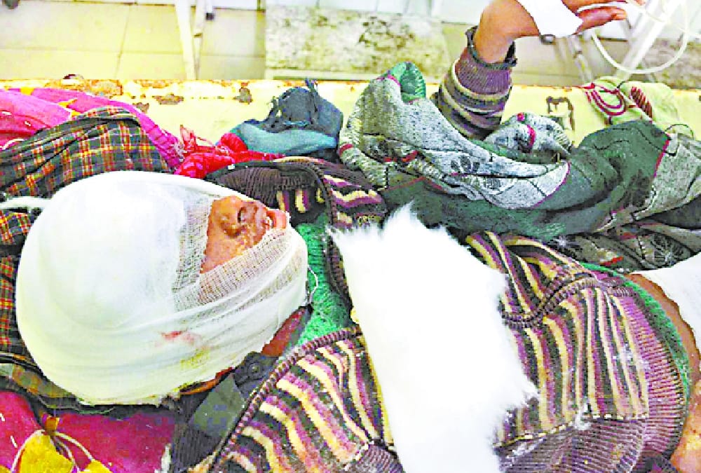 dogs attacked on children in sitapur.