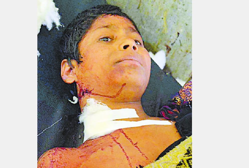 dogs attacked on children in sitapur.