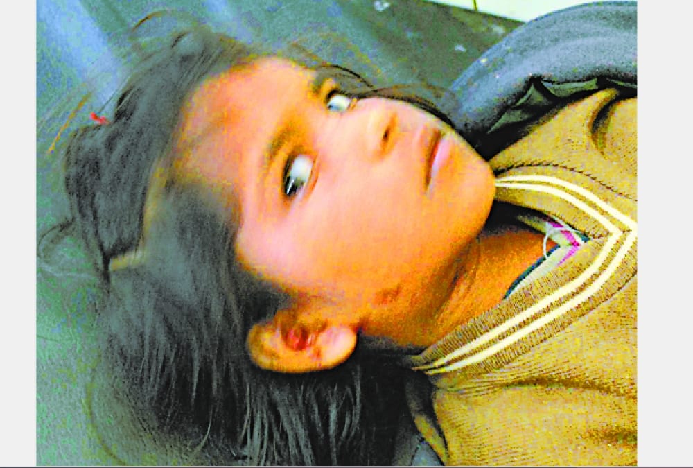 dogs attacked on children in sitapur.