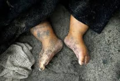 rajasthan ganganagar dead body of children missing in large number