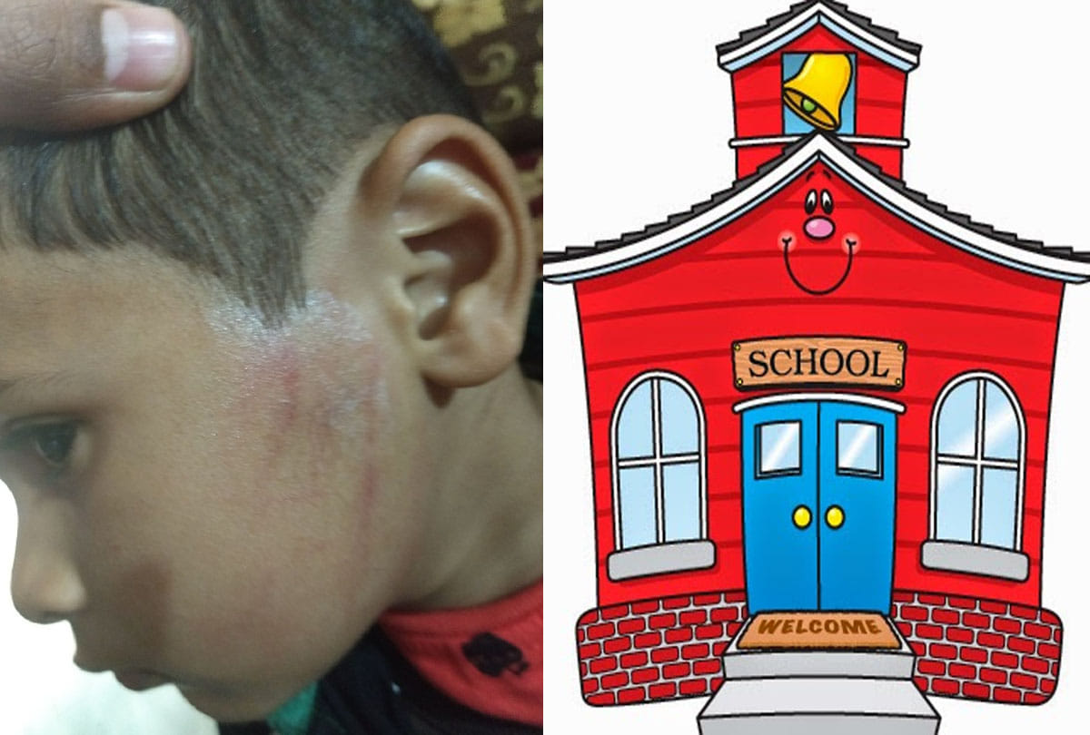 3 years old child slapped by Principal