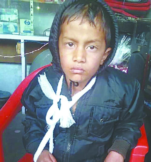 Pig attacked school boy