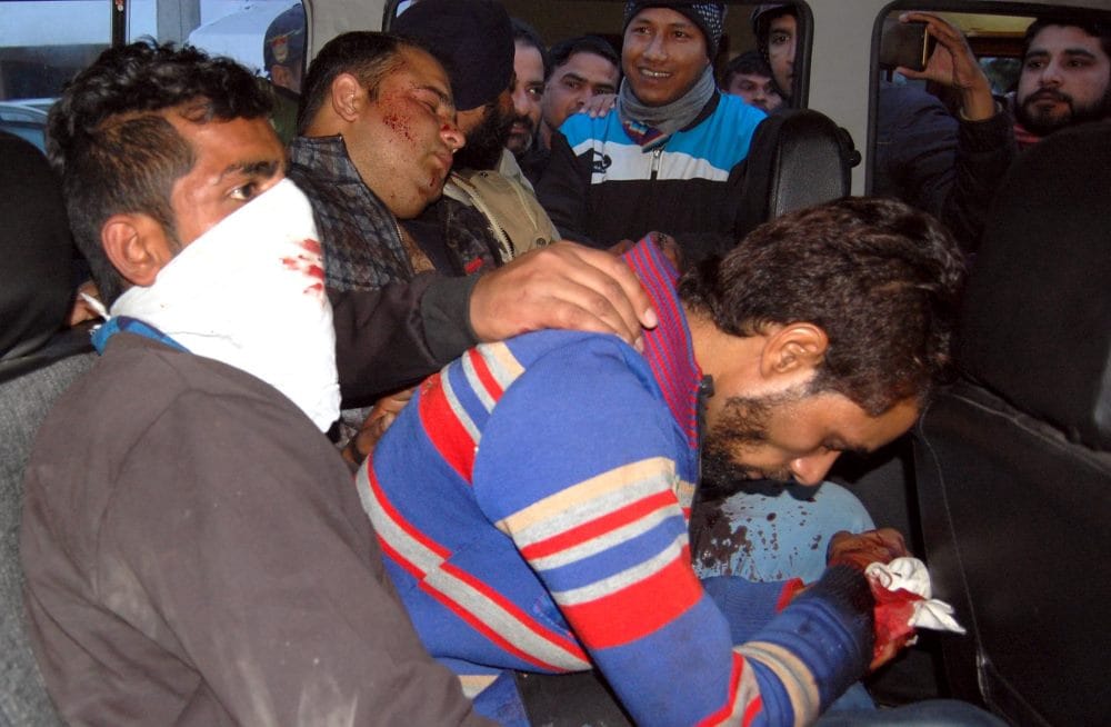 up police firing without knowing uttarakhand police