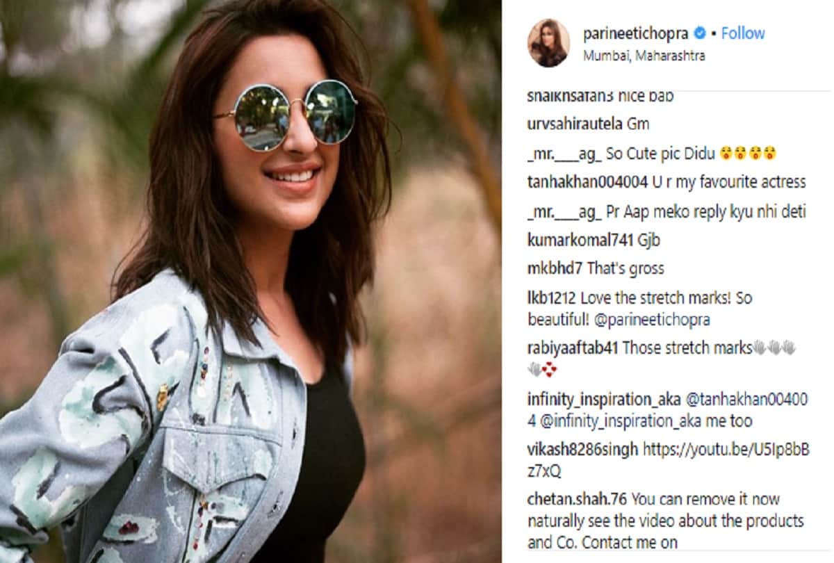 parineeti chopra shrare picture with stretch marks