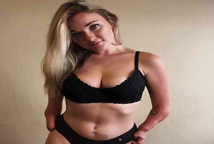 23 year old model molly higgins has artificial hand but popular in instagram