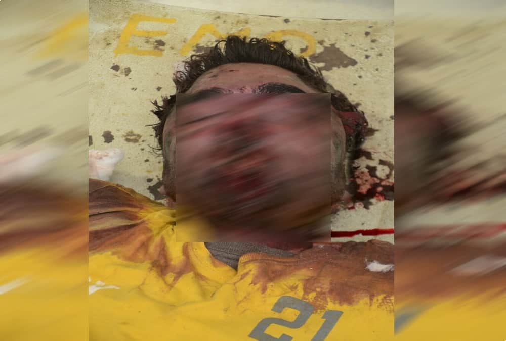 Horrible photos of dead body identification in srinagar