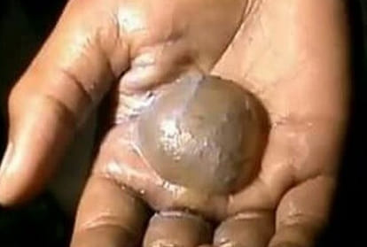 in jharakhand school principal burned students hands for punishment