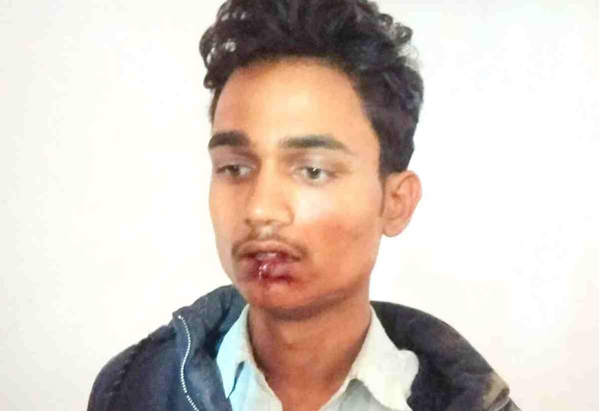 Lover stabbed with knife on girl in Bhadohi