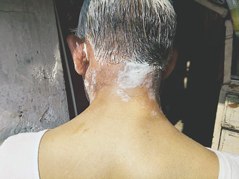 acid thrown at shopkeeper