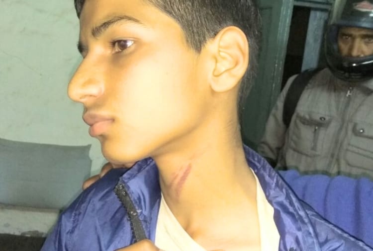 school manager beaten a student badly at hamirpur hp