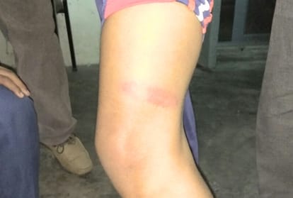 school manager beaten a student badly at hamirpur hp