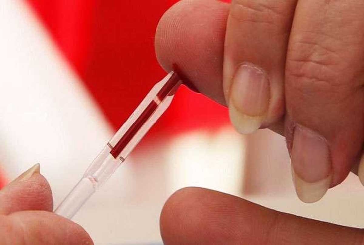 incurable diseases like AIDS made in ten rupees