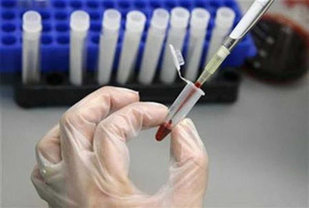 incurable diseases like AIDS made in ten rupees