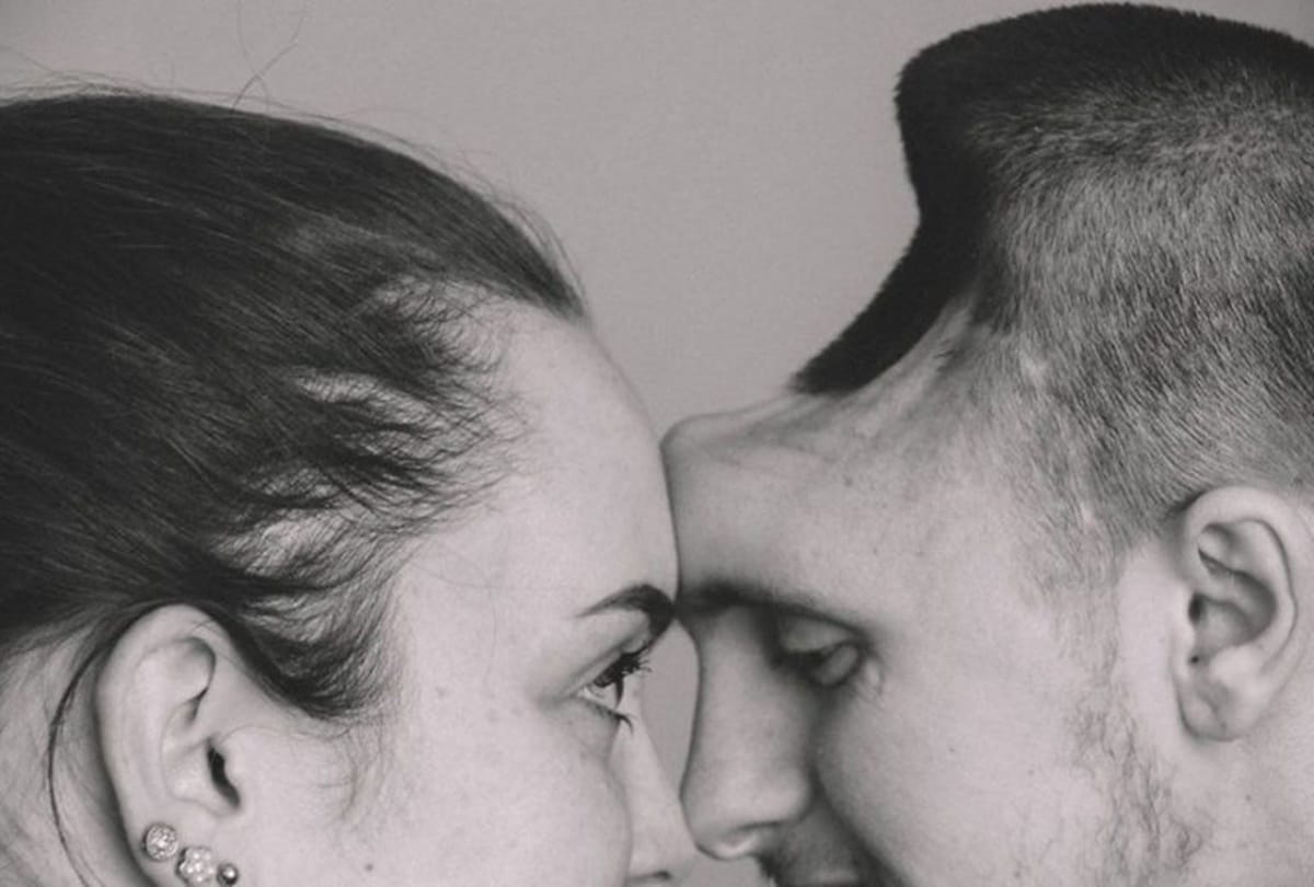 Wife shares touching story of husband who gets hole in skull after overdrinking energy drinks