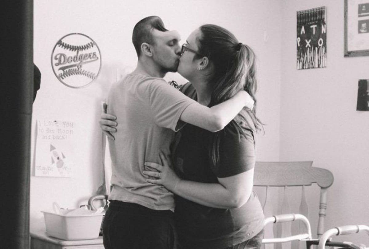 Wife shares touching story of husband who gets hole in skull after overdrinking energy drinks