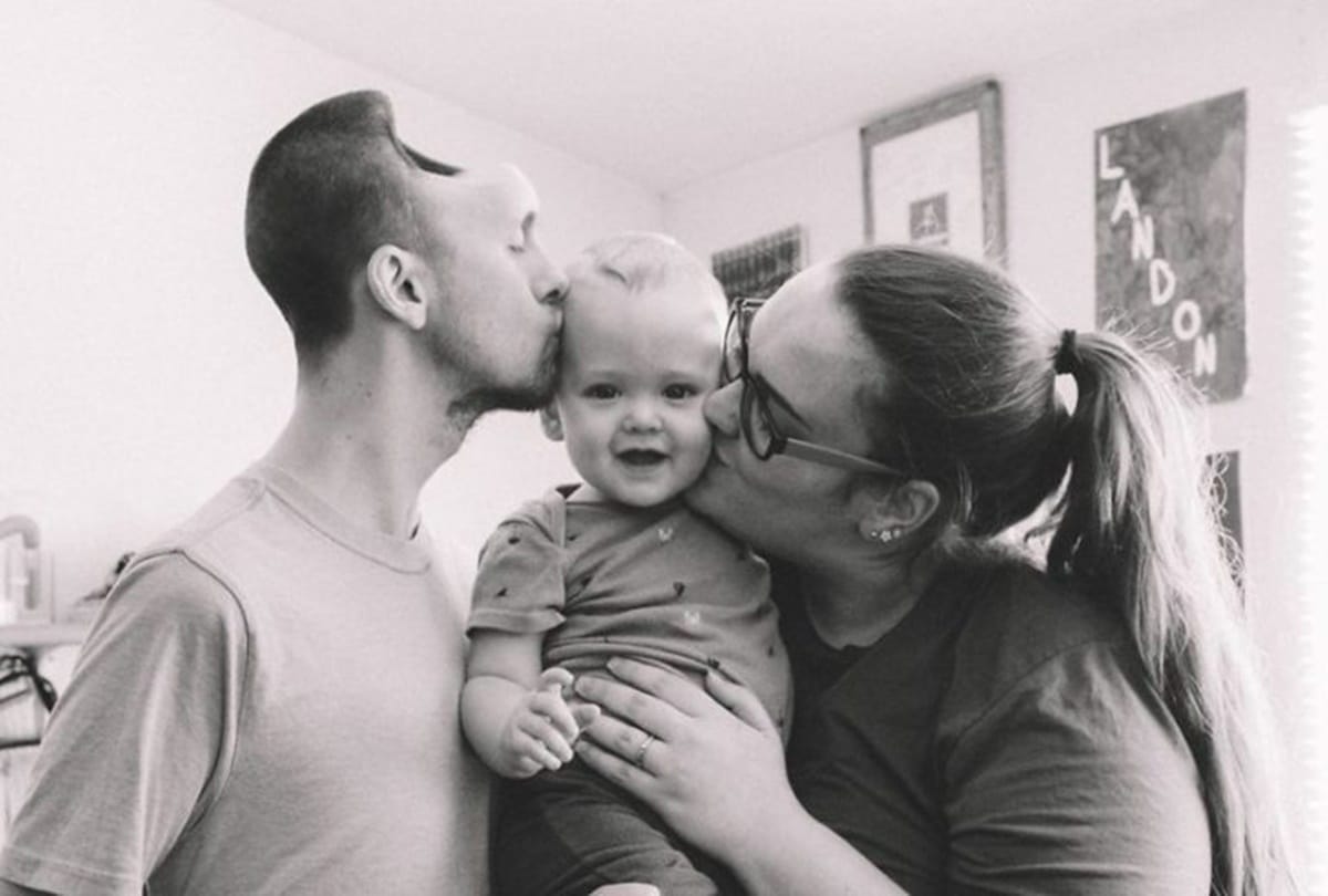 Wife shares touching story of husband who gets hole in skull after overdrinking energy drinks