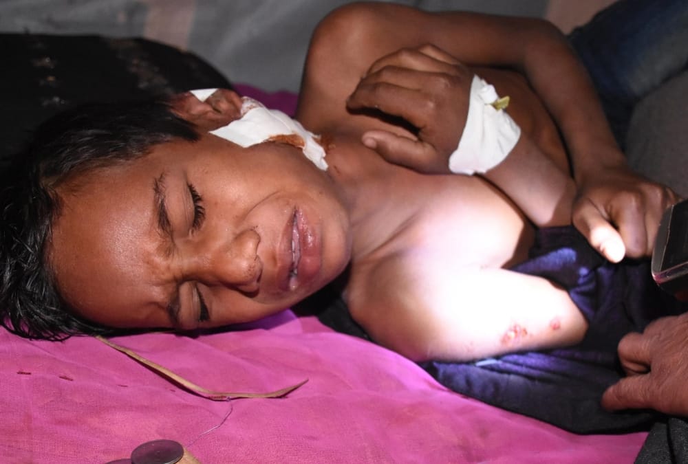 dogs attacked on a boy in lucknow.