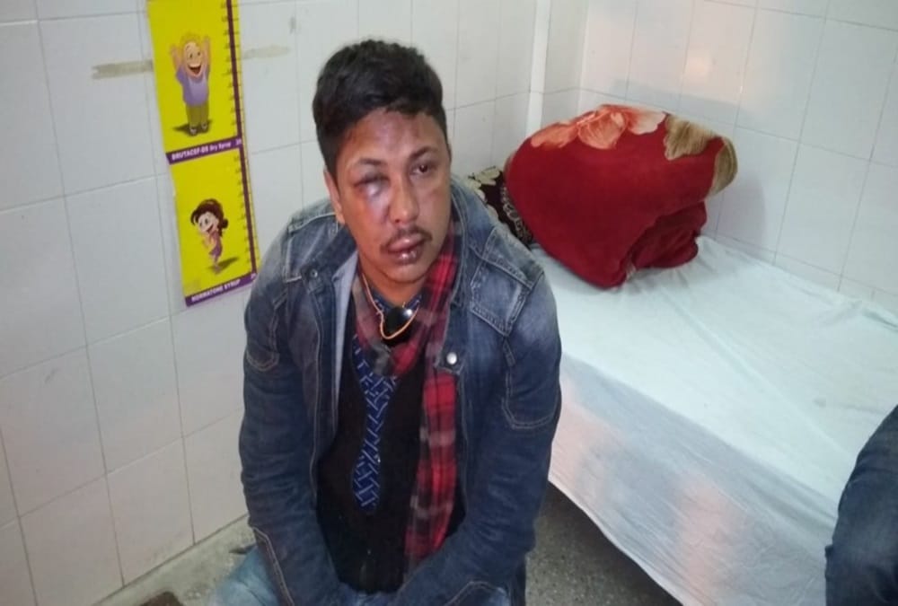 Firing in barat groom brother injured in nainital