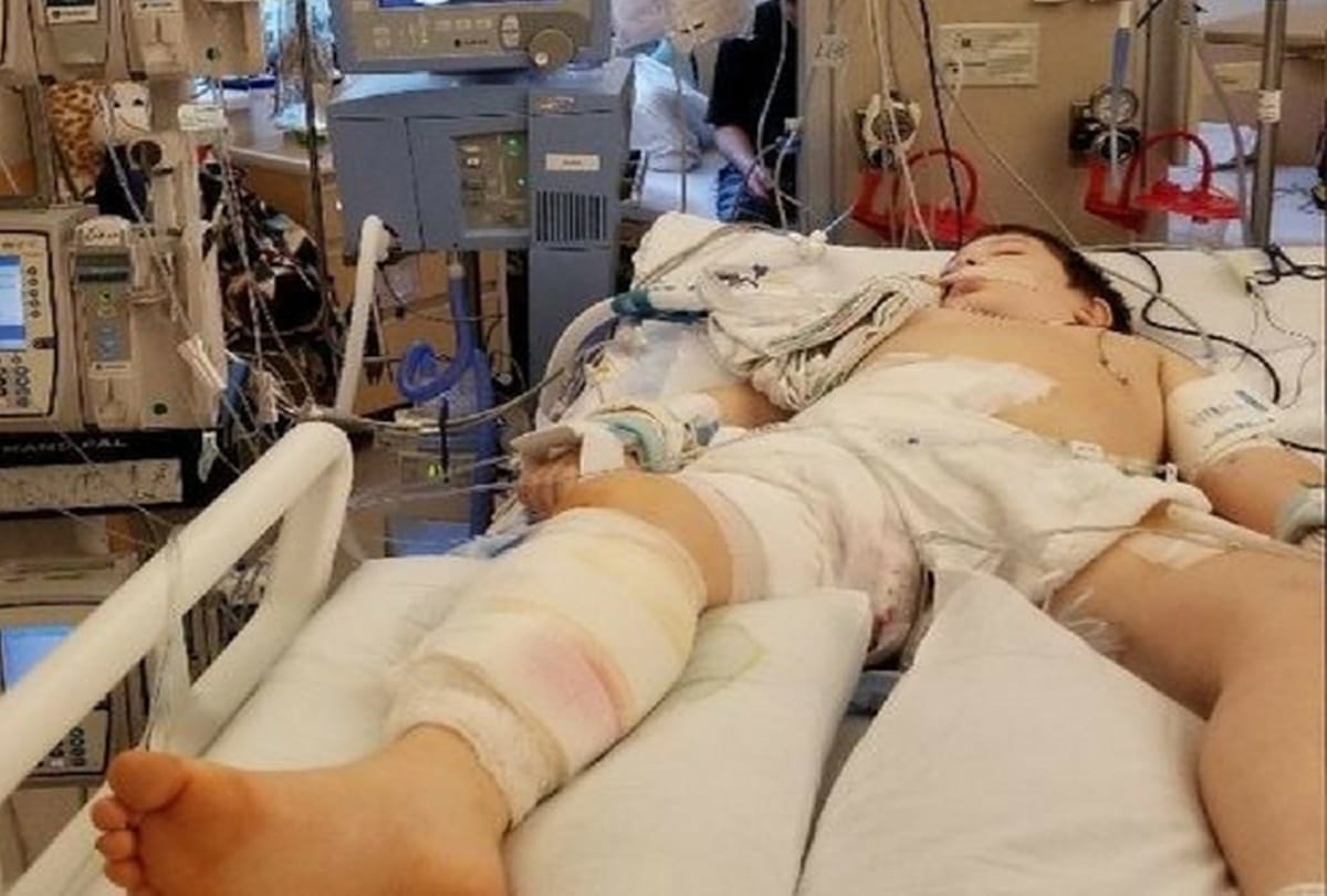 8 year old boy dies from flesh-eating bacteria