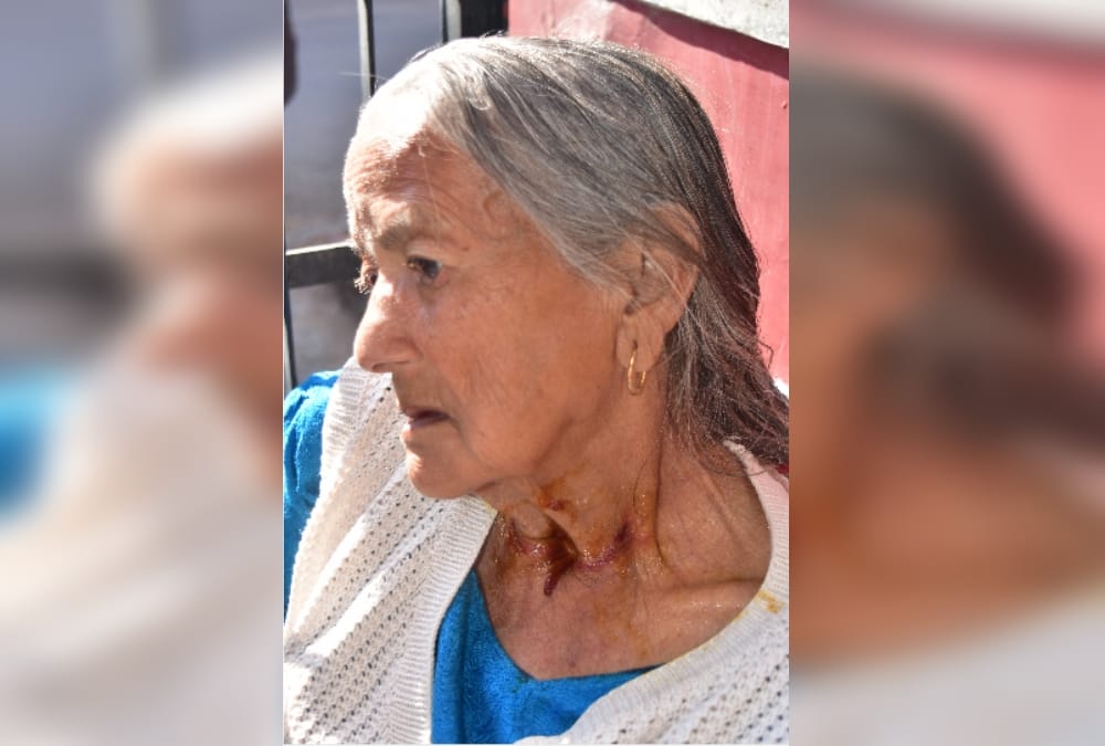 chandigarh police failed to stop snatching incidents