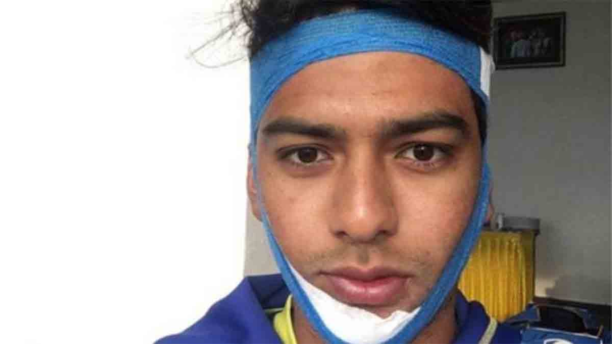 unmukt chand does anil kumble and score a ton with broken jaw