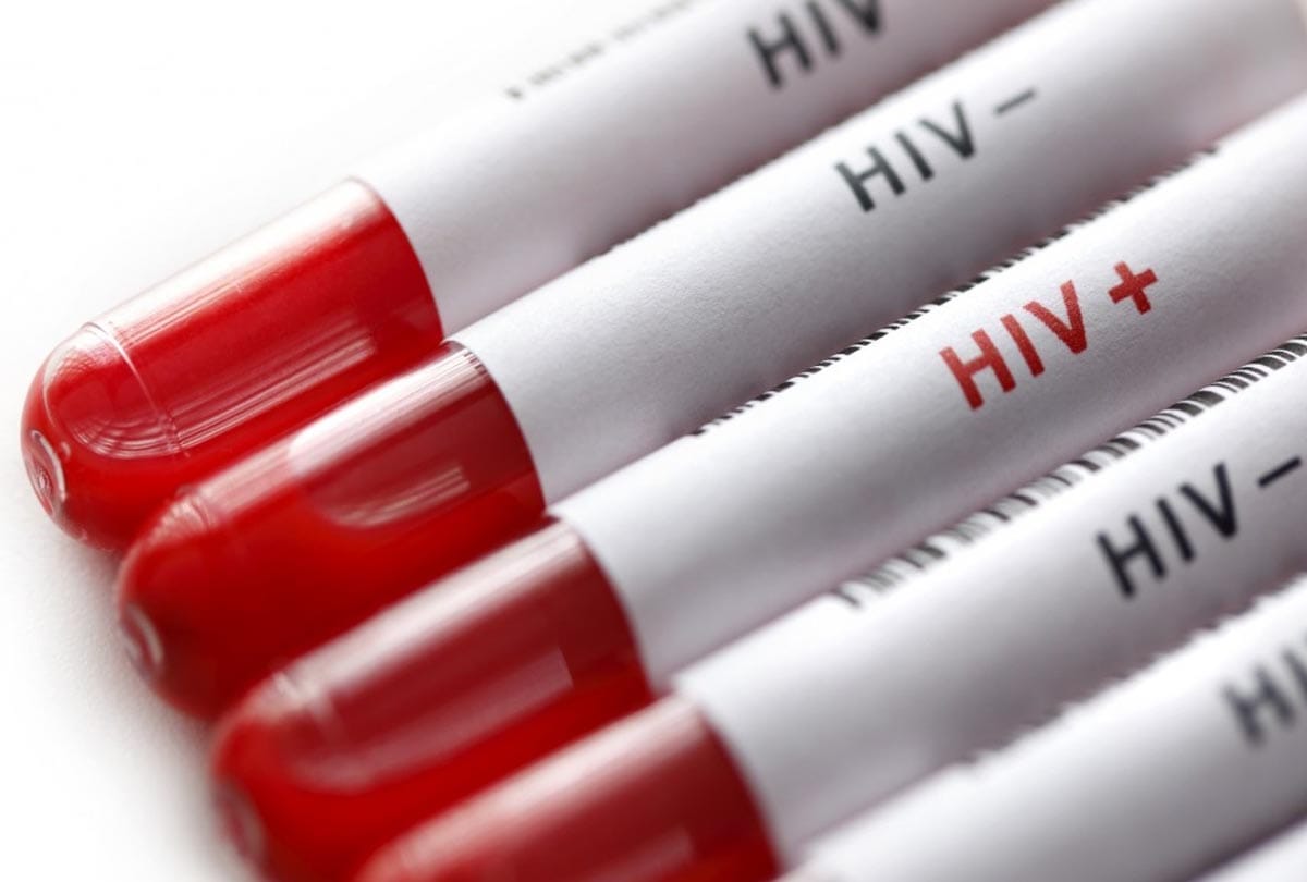 one injection and 10 rupees gives aids