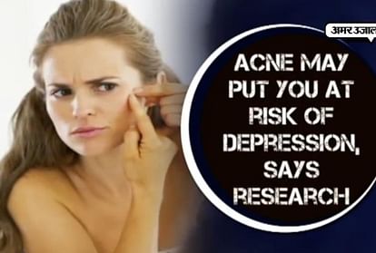 SEE REPORT: DEPRESSION CAUSES ACNE