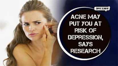 SEE REPORT: DEPRESSION CAUSES ACNE